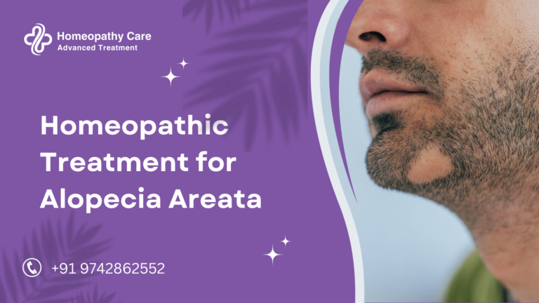 Homeopathic Treatment for Alopecia Areata