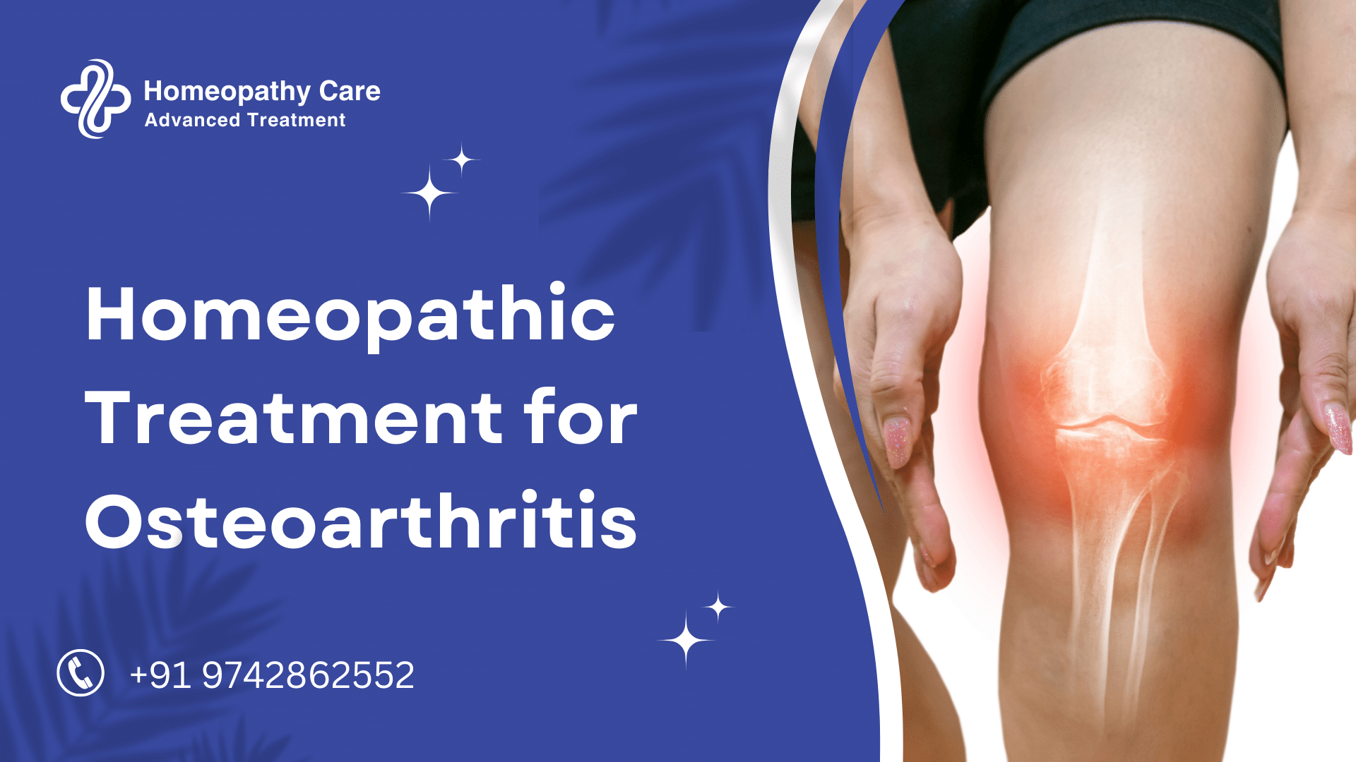 Homeopathic Treatment for Osteoarthritis