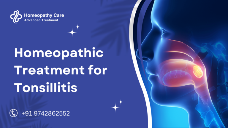 Homeopathic Treatment for Tonsillitis