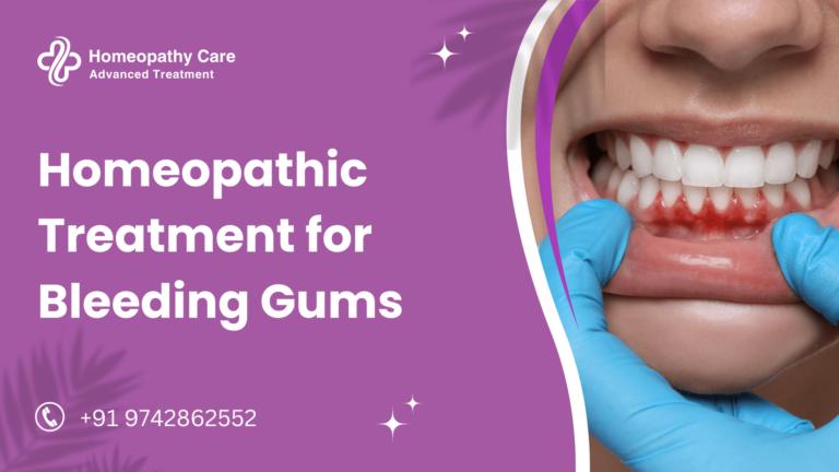 Homeopathic Treatment for Bleeding Gums