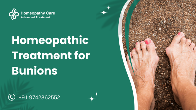 Homeopathic Treatment for Bunions